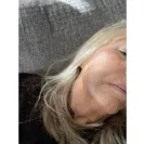 Aspen Dental - Extraction of impacted wisdom tooth  - Photo 2 - update #2255549