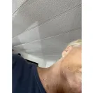 Aspen Dental - Extraction of impacted wisdom tooth  - Photo 4 - update #2255549