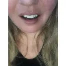 Instasmile - Absolute worst customer service ever - Photo 1 - comment #2495899