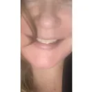 Instasmile - Absolute worst customer service ever - Photo 7 - comment #2495899
