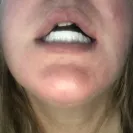 Instasmile - Absolute worst customer service ever - Photo 3 - comment #2495899