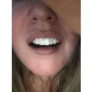 Instasmile - Absolute worst customer service ever - Photo 2 - comment #2495899