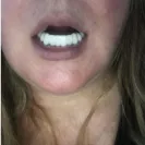Instasmile - Absolute worst customer service ever - Photo 4 - comment #2495899