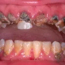 Neibauer Dental Care - fraud - Photo 1 - comment #544484