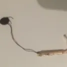 Mirena IUD - Horrible Side Effects - Photo 1 - comment #1768150
