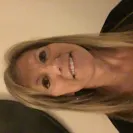 Brenda Jernigan - Liposuction - Photo 1 - update #1718865
