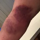 BioLife Plasma Services - Extremely negligent employees - Photo 1 - comment #1719114