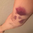 BioLife Plasma Services - Extremely negligent employees - Photo 1 - comment #1721106