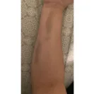 BioLife Plasma Services - Extremely negligent employees - Photo 1 - comment #2282646