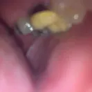 American Dental Centers - Poor dental care, overcharge! - Photo 1 - comment #1254414