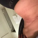Dr Leon Campos - SURGERY GONE EXTREMLY WRONG - Photo 1 - comment #1702003