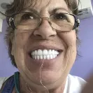 Cancun Cosmetic Dentistry - Bad Dental Work / Unethical Dentists - Photo 1 - comment #2129582