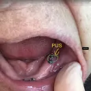 Cancun Cosmetic Dentistry - Bad Dental Work / Unethical Dentists - Photo 1 - comment #2129583