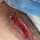 Siamak Agha, MD, PhD, FACS - Bad & disfiguring results/causing restriction of movement - Photo 2 - comment #2241930