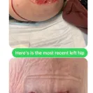 Siamak Agha, MD, PhD, FACS - Bad & disfiguring results/causing restriction of movement - Photo 2 - comment #2554968