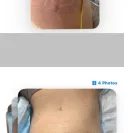 Siamak Agha, MD, PhD, FACS - Bad & disfiguring results/causing restriction of movement - Photo 3 - comment #2554968