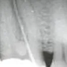 roughandtoothless - dr zietz crowned me - Photo 1 - update #1368898