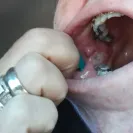 Western Dental Services - Incompetent thieves and liars - Photo 2 - comment #2128953