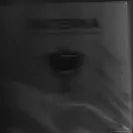 Rapid Fulfillment Services - skintek mole remover - Photo 3 - comment #2056212